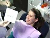 Baton Rouge Zoom whitening - step four
