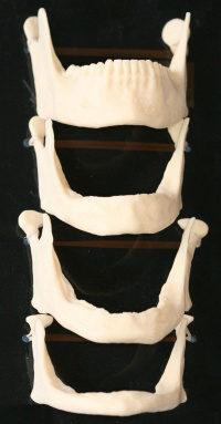 Baton Rouge facial collapse