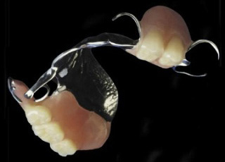 Baton Rouge partial dentures